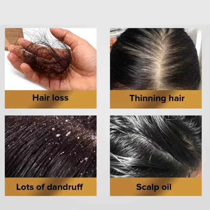 Biotin_Hair_Oil_3 biotin_hair_oil_3
