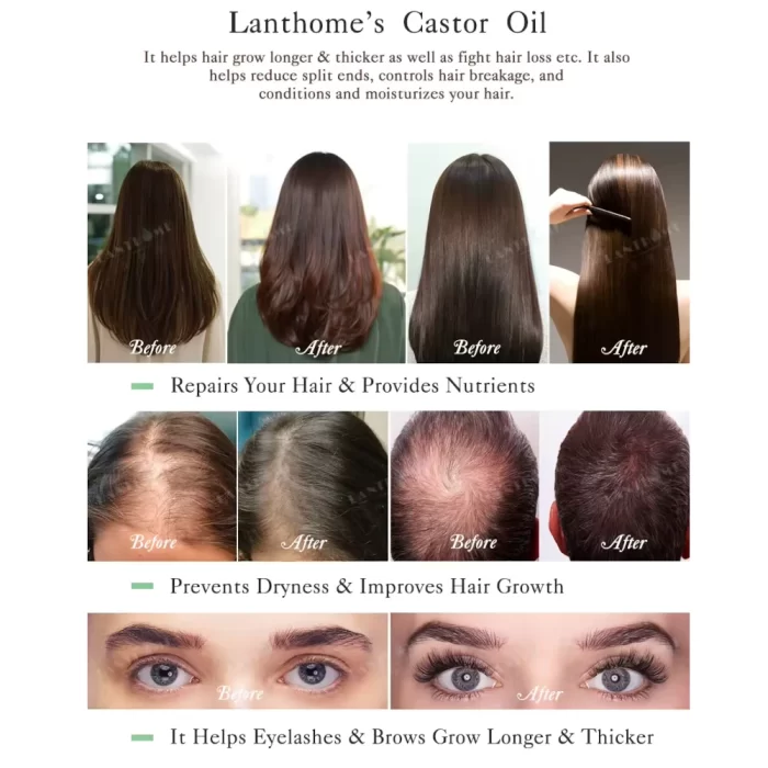 Cold_Pressed_Natural_Castor_Oil_4 cold_pressed_natural_castor_oil_4