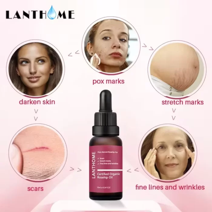 Cold_Pressed_Natural_Rosehip_Oil_2 cold_pressed_natural_rosehip_oil_2