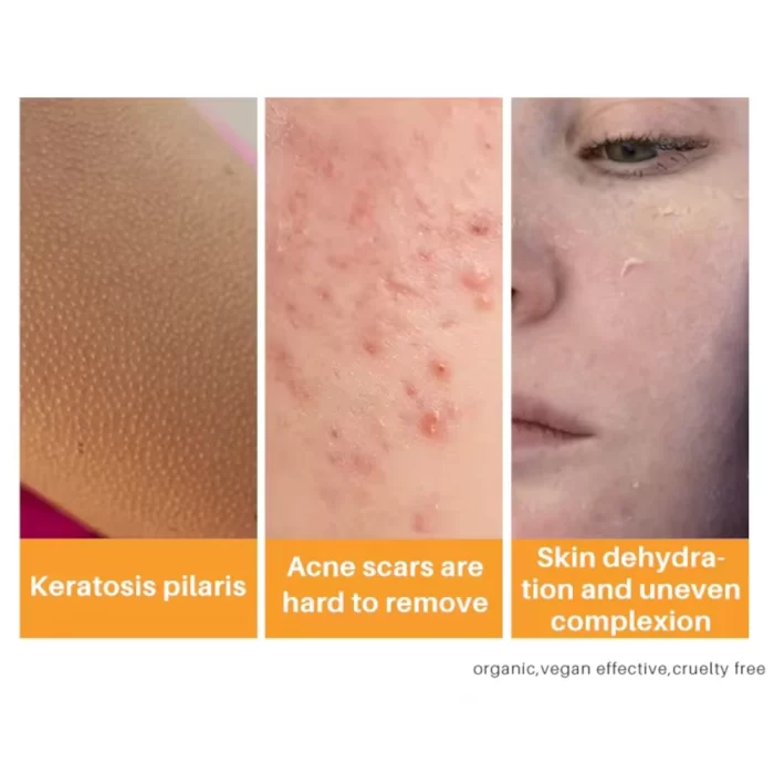 Kojic_Acid_Soap_3_pack_bundle_3 kojic_acid_soap_3_pack_bundle_3