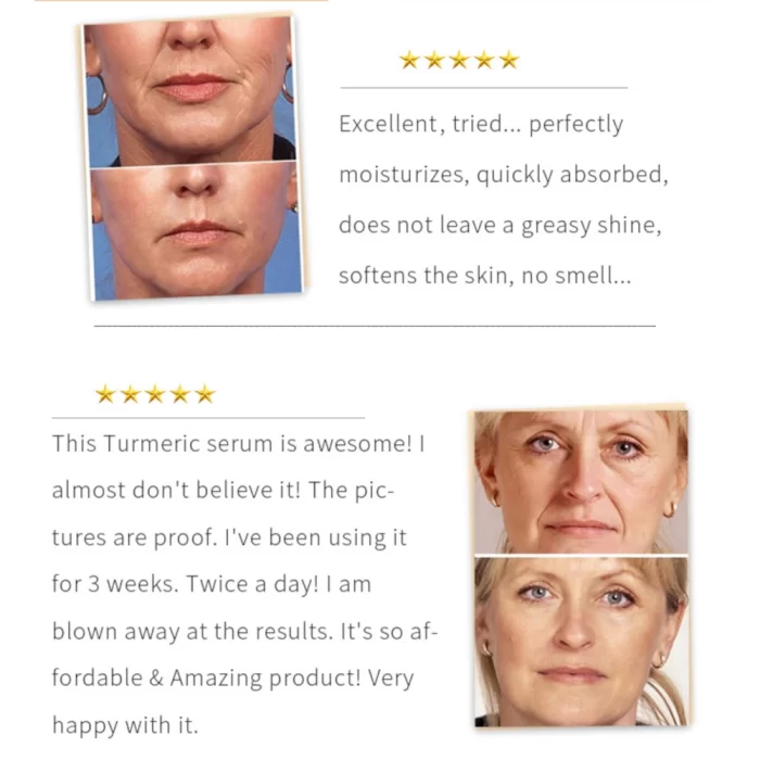 turmeric_self-care_bundle_9 turmeric_self-care_bundle_9